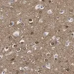 Merck Anti-CRBN Antibody, clone 3I23 ZooMAb Rabbit Monoclonal