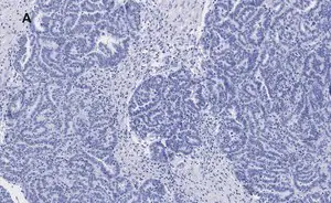 Merck Anti-p53 Antibody, clone 6O23, ZooMAb Rabbit Monoclonal
