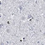 Merck Anti-Olig2 Antibody, clone 211F1.1 ZooMAb Mouse Monoclonal