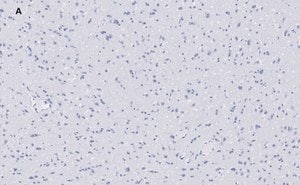 Merck Anti-VGluT1 Antibody, clone 4O15, ZooMAb Rabbit Monoclonal