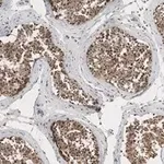 Merck Anti-EZHIP/CXorf67 Antibody, clone 1J8 ZooMAb Rabbit Monoclonal