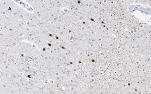 Merck Anti-Calretinin Antibody, clone 3K22, ZooMAb Rabbit Monoclonal