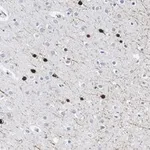 Merck Anti-Calretinin Antibody, clone 3K22, ZooMAb Rabbit Monoclonal