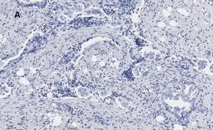 Merck Anti-phospho JNK (Thr183, Tyr185) Antibody, clone 3F7, ZooMAb Rabbit Monoclonal