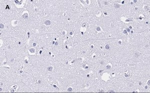 Merck Anti-MBP Antibody, clone 2N6 , ZooMAb Rabbit Monoclonal
