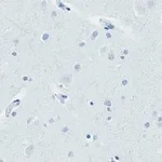 Merck Anti-Huntingtin Protein Antibody, clone 1M11, ZooMAb Rabbit Monoclonal