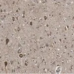 Merck Anti-VGLUT2 Antibody, clone 8G9.2 ZooMAb Mouse Monoclonal