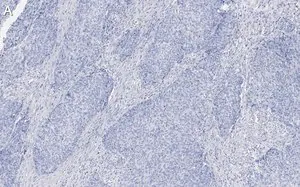 Merck Anti-Integrin β1 Antibody, clone 1A27 , ZooMAb Rabbit Monoclonal