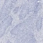 Merck Anti-Integrin β1 Antibody, clone 1A27 , ZooMAb Rabbit Monoclonal