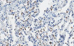 Merck Anti-SFTPC Antibody, clone 3F18 ZooMAb Rabbit Monoclonal