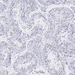 Merck Anti-Golgin-97 Antibody, clone 4K16, ZooMAb Rabbit Monoclonal