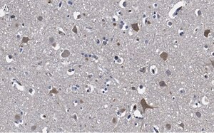 Merck Anti-Stathmin-2 Antibody, clone 1B3 ZooMAb Rabbit Monoclonal