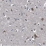 Merck Anti-Stathmin-2 Antibody, clone 1B3 ZooMAb Rabbit Monoclonal