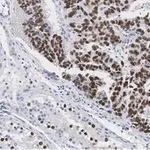 Merck Anti-Nanog Antibody, clone 4C17 ZooMAb Rabbit Monoclonal