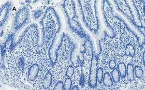 Merck Anti-AMPK alpha Antibody, clone 2D22, ZooMAb Rabbit Monoclonal