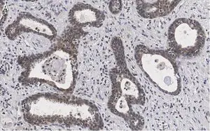 Merck Anti-RAR-alpha Antibody, clone 3L14, ZooMAb Rabbit Monoclonal