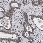 Merck Anti-RAR-alpha Antibody, clone 3L14, ZooMAb Rabbit Monoclonal