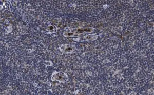 Merck Anti-PD-1 Antibody, clone 1F7 ZooMAb Rabbit Monoclonal