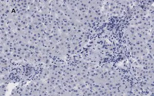 Merck Anti-LDL Receptor Antibody, clone 2N19, ZooMAb Rabbit Monoclonal