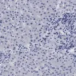 Merck Anti-LDL Receptor Antibody, clone 2N19, ZooMAb Rabbit Monoclonal