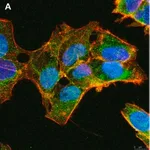 Merck Anti-ULBP-3 Antibody, clone 3C10 ZooMAb Rabbit Monoclonal