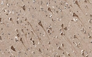 Merck Anti-TPH-1 Antibody, clone 3J7 ZooMAb Rabbit Monoclonal