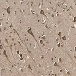 Merck Anti-TPH-1 Antibody, clone 3J7 ZooMAb Rabbit Monoclonal