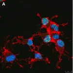 Merck Anti-Olig2 Antibody, clone 1K2 ZooMAb Rabbit Monoclonal