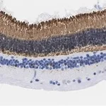 Merck Anti-Recoverin Antibody, clone 1K10 ZooMAb Rabbit Monoclonal