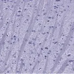 Merck Anti-Synaptophysin Antibody, clone 1G7, ZooMAb Rabbit Monoclonal