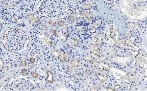 Merck Anti-CDK6 Antibody, clone 2J3 ZooMAb Rabbit Monoclonal