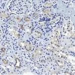 Merck Anti-CDK6 Antibody, clone 2J3 ZooMAb Rabbit Monoclonal