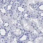 Merck Anti-VDAC1 Antibody, clone 3M22, ZooMAb Rabbit Monoclonal