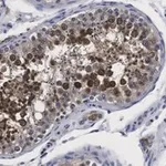 Merck Anti-Centrin Antibody, clone 20H5 ZooMAb Mouse Monoclonal