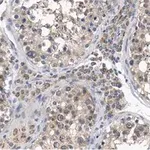 Merck Anti-PGAM5 Antibody, clone 2J4 ZooMAb Rabbit Monoclonal