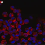 Merck Anti-Influenza A Nucleoprotein Antibody, clone A3 ZooMAb Mouse Monoclonal
