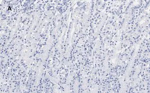 Merck Anti-IKB α Antibody, clone 6O8, ZooMAb Rabbit Monoclonal