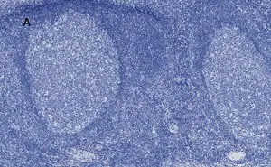 Merck Anti-Aurora B Antibody, clone 7C4, ZooMAb Rabbit Monoclonal