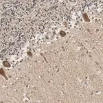 Merck Anti-GluR-2 Antibody, clone 1K20 ZooMAb Rabbit Monoclonal