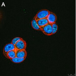 Merck Anti-Ubiquilin 4 Antibody, clone 5K6 ZooMAb Rabbit Monoclonal