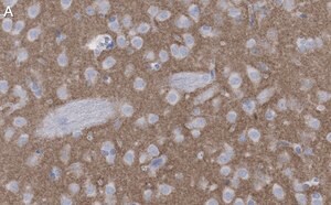 Merck Anti-mGluR5 Antibody, clone 1F11 ZooMAb Rabbit Monoclonal