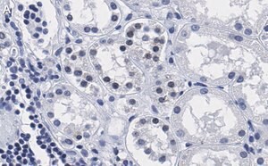 Merck Anti-PARP-1 Antibody, clone 12N17 Antibody, ZooMAb Rabbit Monoclonal