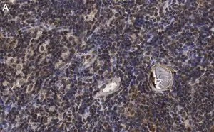 Merck Anti-RORγ Antibody, clone 6F3.1 ZooMAb Mouse Monoclonal