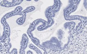 Merck Anti-SOX17 Antibody, clone 3F7, ZooMAb Rabbit Monoclonal