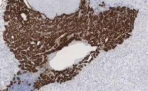 Merck Anti-Dopamine β Hydroxylase Antibody, clone 2B11 ZooMAb Rabbit Monoclonal