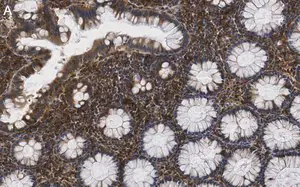 Merck Anti-MMP14 Antibody, clone LEM-2/15.8 ZooMAb Mouse Monoclonal