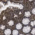 Merck Anti-MMP14 Antibody, clone LEM-2/15.8 ZooMAb Mouse Monoclonal