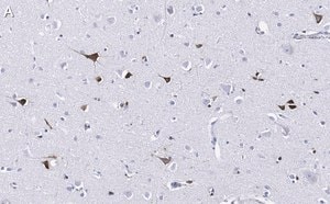Merck Anti-Prion Protein Antibody, clone 3F17 ZooMAb Rabbit Monoclonal