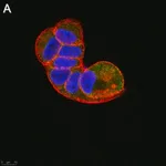 Merck Anti-TSG101 Antibody, clone 2H18 ZooMAb Rabbit Monoclonal