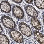 Merck Anti-MMP-14 Antibody, clone 1J5 ZooMAb Rabbit Monoclonal